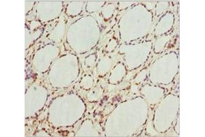 Immunohistochemistry of paraffin-embedded human thyroid tissue using ABIN7154750 at dilution of 1:100 (GNB1L 抗体  (AA 1-327))