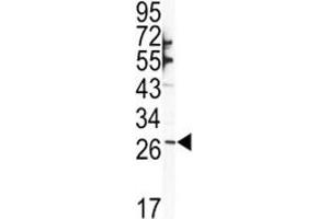 Western Blotting (WB) image for anti-SNAIL (SNAI1) (AA 1-30) antibody (ABIN3029018)