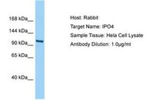 Image no. 1 for anti-Importin 4 (IPO4) (AA 468-517) antibody (ABIN6750201) (Importin 4 抗体  (AA 468-517))