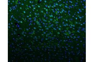 IF analysis of KCNA1 using anti-KCNA1 antibody (ABIN6719578).