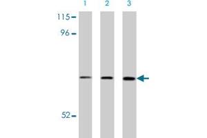 Western blot analysis of CRMP1 in NIH/3T3 cell lysate with CRMP1 polyclonal antibody at (A) 0. (CRMP1 抗体  (C-Term))