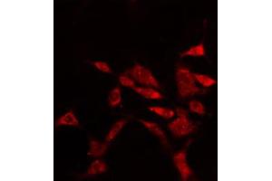 ABIN6274897 staining Hela cells by IF/ICC. (EPB41L2 抗体  (Internal Region))