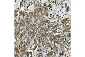 IHC analysis of TRIM25 using anti-TRIM25 antibody (ABIN7599495). (TRIM25 抗体  (AA 1-610))