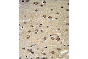 Immunohistochemistry (Paraffin-embedded Sections) (IHC (p)) image for anti-delta-Like 2 Homolog (DLK2) (AA 353-380), (C-Term) antibody (ABIN652972)