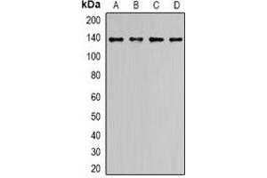 Western blot analysis of ALPK1 expression in LO2 (A), HCT116 (B), COLO205 (C), HepG2 (D) whole cell lysates. (ALPK1 抗体  (N-Term))