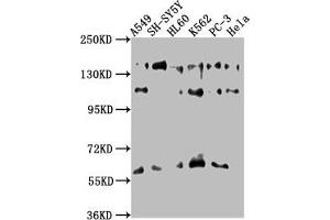 Western Blot Positive WB detected in: A549 whole cell lysate, SH-SY5Y whole cell lysate, HL60 whole cell lysate, K562 whole cell lysate, PC-3 whole cell lysate, Hela whole cell lysate All lanes: SOS2 antibody at 1:1000 Secondary Goat polyclonal to rabbit IgG at 1/50000 dilution Predicted band size: 153, 150 kDa Observed band size: 153 kDa (SOS2 抗体  (AA 187-404))