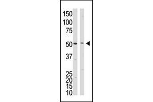 Western Blotting (WB) image for anti-Presenilin 1 (PSEN1) (C-Term) antibody (ABIN358721) (Presenilin 1 抗体  (C-Term))