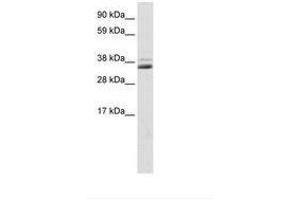 Image no. 1 for anti-Secreted Frizzled-Related Protein 1 (SFRP1) (C-Term) antibody (ABIN202220) (SFRP1 抗体  (C-Term))