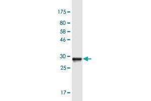 Western Blot detection against Immunogen (31. (SOX5 抗体  (AA 181-230))