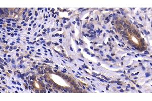 Detection of CASP9 in Rat Uterus Tissue using Polyclonal Antibody to Caspase 9 (CASP9) (Caspase 9 抗体  (AA 1-200))