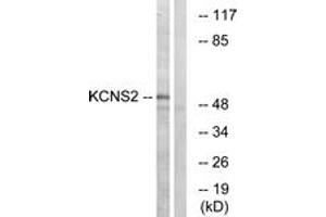 Western blot analysis of extracts from HepG2 cells, using KCNS2 Antibody. (KCNS2 抗体  (AA 197-246))