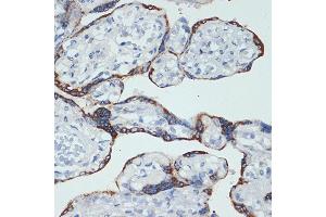 Immunohistochemistry of paraffin-embedded human placenta using HSD3B1 Rabbit mAb (ABIN7267801) at dilution of 1:100 (40x lens). (HSD3B1 抗体)