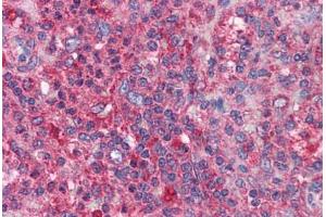 Human Spleen: Formalin-Fixed, Paraffin-Embedded (FFPE) (BIRC3 抗体  (AA 314-508))