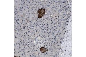 Immunohistochemical staining of human pancreas with ZDHHC15 polyclonal antibody  shows strong cytoplasmic positivity in islet cells. (ZDHHC15 抗体)
