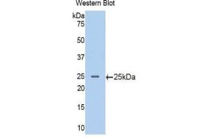 Western blot analysis of the recombinant protein. (PIK3CB 抗体  (AA 524-703))