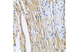 Immunohistochemistry of paraffin-embedded mouse heart using GOLM1 antibody. (GOLM1 抗体  (AA 112-401))