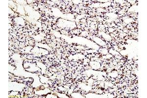 Immunohistochemistry (Paraffin-embedded Sections) (IHC (p)) image for anti-Low Density Lipoprotein Receptor-Related Protein 8, Apolipoprotein E Receptor (LRP8) (AA 851-963) antibody (ABIN719426)