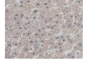 IHC-P analysis of Human Liver Tissue, with DAB staining. (Antizyme Inhibitor 1 抗体  (Lys290))