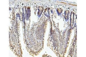 anti-Ring Finger Protein 169 (RNF169) (AA 311-708) antibody