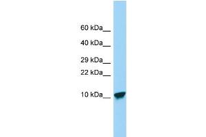 Host: Rabbit Target Name: SPINK9 Sample Type: Placenta lysates Antibody Dilution: 1. (SPINK9 抗体  (Middle Region))