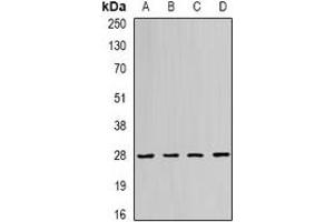 Western blot analysis of RAB11A expression in Jurkat (A), SHSY5Y (B), PC12 (C), mouse spleen (D) whole cell lysates. (RAB11A 抗体)