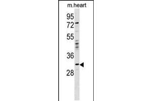 Western blot analysis in mouse heart tissue lysates (35ug/lane). (OTP 抗体  (AA 88-115))