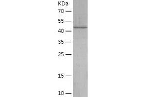Western Blotting (WB) image for Fetuin B (FETUB) (AA 177-382) protein (His-IF2DI Tag) (ABIN7122906)