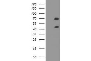 Image no. 1 for anti-tRNA Methyltransferase 2 Homolog A (TRMT2A) antibody (ABIN1501521) (TRMT2A 抗体)