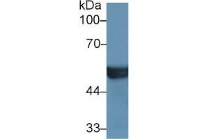 Western Blotting (WB) image for anti-Cytochrome P450, Family 2, Subfamily D, Polypeptide 6 (CYP2D6) (AA 236-472) antibody (ABIN7437350)