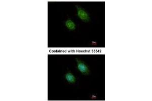 ICC/IF Image Immunofluorescence analysis of methanol-fixed HeLa, using CaMK1D, antibody at 1:500 dilution. (CAMK1D 抗体)