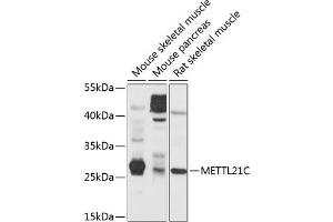 Western blot analysis of extracts of various cell lines, using METTL21C antibody (ABIN6131461, ABIN6143763, ABIN6143764 and ABIN6214649) at 1:1000 dilution. (METTL21C 抗体  (AA 1-264))
