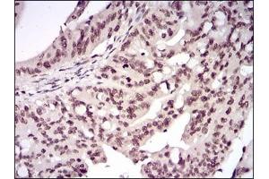 anti-V-Rel Reticuloendotheliosis Viral Oncogene Homolog B (RELB) (AA 273-443) antibody