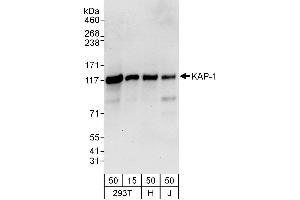 Western Blotting (WB) image for anti-Tripartite Motif Containing 28 (TRIM28) (AA 1-50) antibody (ABIN7453437)