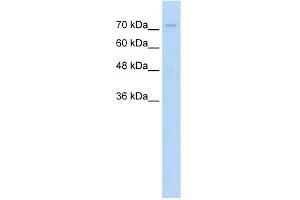 WB Suggested Anti-FOXP2 Antibody  Titration: 0. (FOXP2 抗体  (N-Term))