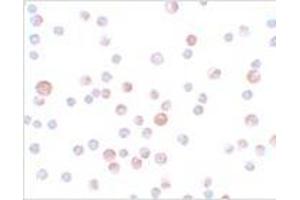Immunocytochemistry of CaBP7 in HeLa cells with CaBP7 antibody at 4 μg/ml. (CABP7 抗体  (N-Term))