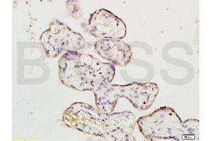 Formalin-fixed and paraffin embedded human placenta labeled with Rabbit Anti ERK1/MAPK3 Polyclonal Antibody, Unconjugated (ABIN736476) at 1:200 followed by conjugation to the secondary antibody and DAB staining (ERK1 抗体  (AA 101-200))
