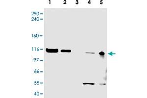 Western blot using ATAD5 polyclonal antibody  shows detection of a band ~120 KDa corresponding to human ATAD5 (arrowhead) in various cell lysates. (ATAD5 抗体  (AA 63-76))