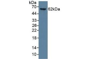 Detection of CK9 in Human Lung Tissue using Monoclonal Antibody to Cytokeratin 9 (CK9) (KRT9 抗体  (AA 315-456))