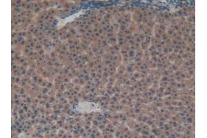 IHC-P analysis of Rat Liver Tissue, with DAB staining. (FGFRL1 抗体  (AA 164-368))