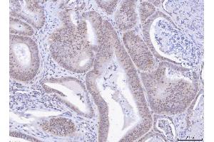 IHC analysis of TOX using anti-TOX antibody (ABIN7599443).