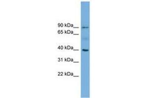 Image no. 1 for anti-Hemochromatosis (HFE) (AA 35-84) antibody (ABIN6744769) (HFE 抗体  (AA 35-84))