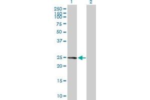 Western Blot analysis of FKBP7 expression in transfected 293T cell line by FKBP7 MaxPab polyclonal antibody. (FKBP7 抗体  (AA 1-222))