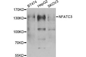 Western blot analysis of extracts of various cell lines, using NFATC3 antibody (ABIN5974017) at 1/1000 dilution. (NFATC3 抗体)