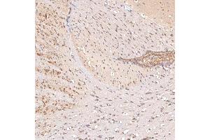 IHC analysis of SGCE using anti-SGCE antibody (ABIN7601544). (SGCE 抗体  (AA 38-407))