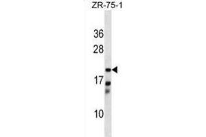 Western Blotting (WB) image for anti-Carbonyl Reductase 4 (CBR4) antibody (ABIN5019097) (CBR4 抗体)