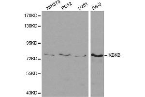 Western blot analysis of extracts of various cell lines, using IKBKB antibody (ABIN5971113) at 1/500 dilution. (IKBKB 抗体)