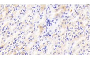 Immunohistochemistry (IHC) image for anti-Laminin, beta 1 (LAMB1) (AA 1053-1258) antibody (ABIN7439090)