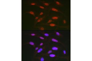 Immunofluorescence analysis of U2OS cells using Phospho-c-Jun-T91 Rabbit pAb (ABIN7268058) at dilution of 1:50 (40x lens). (C-JUN 抗体  (pThr91))