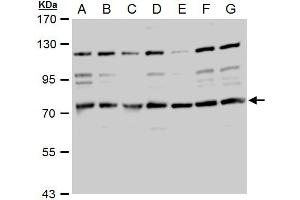 WB Image TACC2 antibody detects TACC2 protein by western blot analysis. (TACC2 抗体  (N-Term))