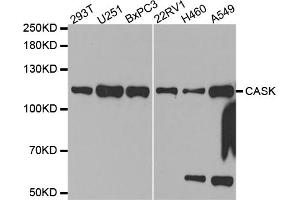 Western blot analysis of extracts of various cell lines, using CASK antibody. (CASK 抗体)